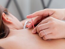 鍼灸ヨスガ(鍼灸Yosga)の雰囲気（完全予約制お一人お一人のお体に合わせて施術行います）