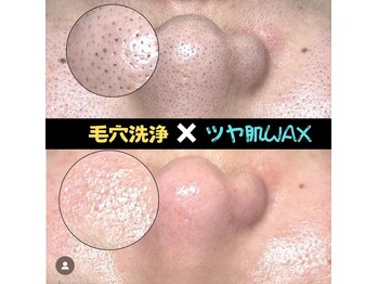 ディエール(Diailes)/ツヤ肌WAX × 毛穴洗浄