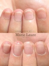 マリーロール 淀屋橋本店(Marie Laure)/自爪育成/深爪矯正/ネイルケア