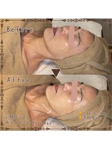 プライベートサロン レイ(Ray)/小顔コース