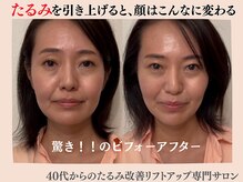 エンジェルエッグ