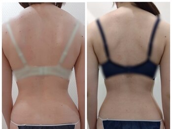 アイディエム 新宿店(IDM)/【モニター】１６９cm・20代