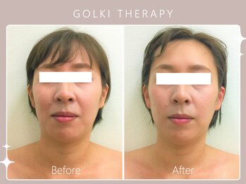 シロカネ 光の森店(SHIROKANE)/韓国式小顔コルギ☆