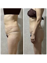 スリーピングビューティー(Sleeping Beauty)/