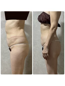 スリーピングビューティー(Sleeping Beauty)/