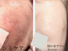 ミーシェ(Meshine)