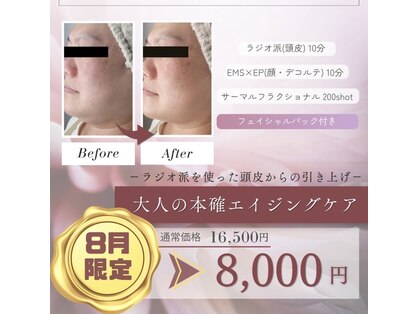 フェイス(TwinQle)の写真