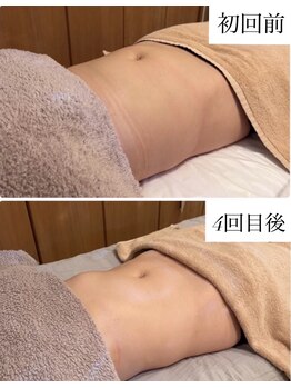 クレアス 勝どき(CREAS)の写真/ぽっこりお腹の原因は腸？内側から整えて本気のサイズダウンへ
骨盤周りから整えて足まで軽くなる腸揉み