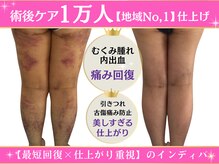 インディバ痩身サロン プルミエ(premier)