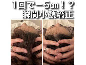 サロン ド カシェット 表参道/頭蓋骨小顔調整＋オリジナル小顔