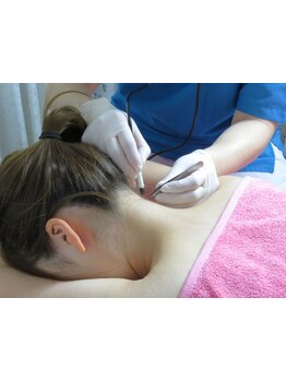 全身脱毛コースのあるサロン