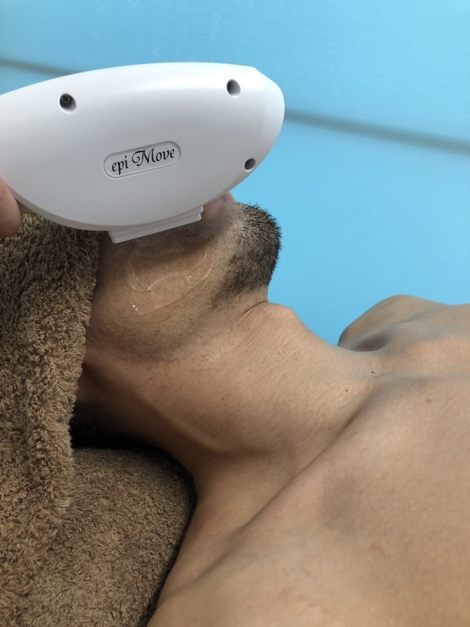 メンズ髭脱毛 \3300