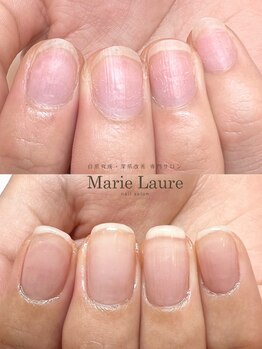 マリーロール 梅田店(Marie Laure)/自爪育成/深爪矯正/ネイルケア