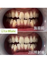 ルブラン 奈良店(Le Blanc)/お忙しい方にも！