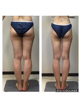 美ボディラボ(美Body Labo)/