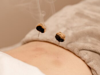 はりきゅうすず風/お灸の様子