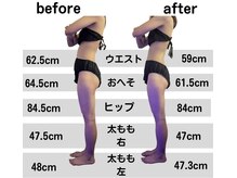 輝 らいとの雰囲気（大人気の痩身エステ★気になる部分を集中攻撃◎効果絶大高評価◎）