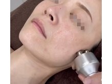 エヌフェイシャル(N.facial)/【ＲＦ】