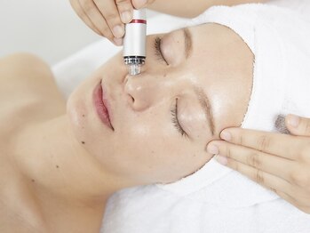 ニキビ研究所 千葉店の写真/【ニキビケア・毛穴ケア（肌診断&洗顔指導付）】繰り返す肌荒れも徹底改善!自信の持てる素肌へ