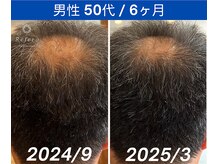 リフェロ 豊橋店(Refero)/Refero6本使用変化