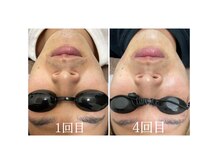 フォルチェ 神辺店(Folche)