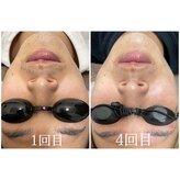 フォルチェ 神辺店(Folche)