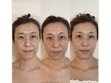 クローバー(clover)の雰囲気(年齢のせいにしない。いつだって印象は変えられる小顔整顔)