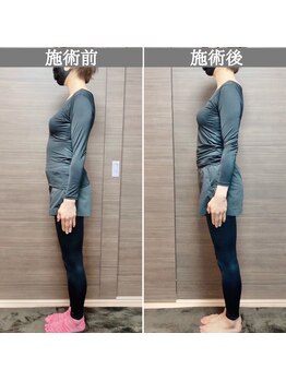 シェア 人形町店(Chare)/【小顔・骨盤矯正・О脚・整体】