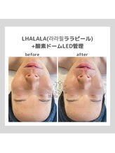 ポムハヌル(pom.haneul)/韓国肌管理室