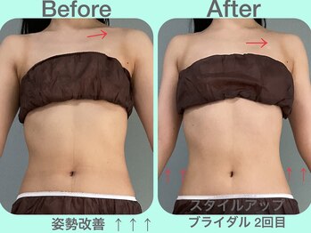 ビーナイス ビューティー(Be Nice Beauty)/かけこみブライダルでも結果◎