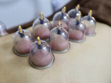 ビビオンリーワン 銀座築地(vivi only one)/【オプション】カッピング