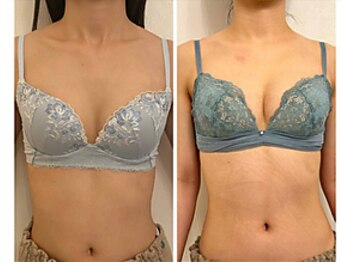 美人バスト 千葉店/バストケア