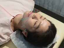 バナナ(Banana)/【整骨/鍼灸マッサージ】＃板橋