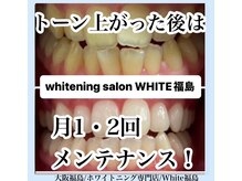 ホワイトニングサロン ホワイト(WHITE)/セルフホワイトニング/大阪/福島