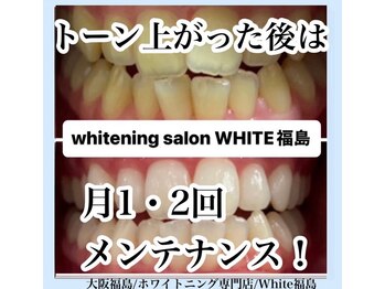 ホワイトニングサロン ホワイト(WHITE)/セルフホワイトニング/大阪/福島