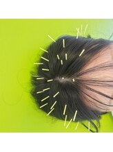 はり灸心音/頭鍼比較-おすすめ☆☆