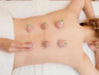 健康堂整体 烏丸今出川院/カッピング・吸い玉