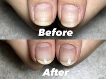 結(Yui)/自爪育成 Before→After