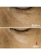 ラボーテ(La Beaute)/