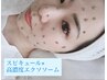【最先端ピーリング】高濃度エクソソーム導入!HAABエピダーマルスキン