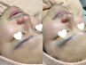 メンズフェイシャル◆大人気！肌育できる毛穴・むくみスッキリ小顔コース