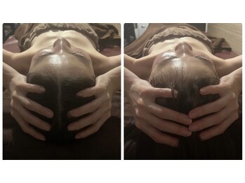 ライズサロン(RiseSALON)/【頭筋膜ヘッド小顔】症例