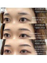 わたしいろ/HBLビフォーアフター