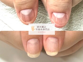 グラシナ 鳥丸店/(深爪/長さだし/フィルイン/)