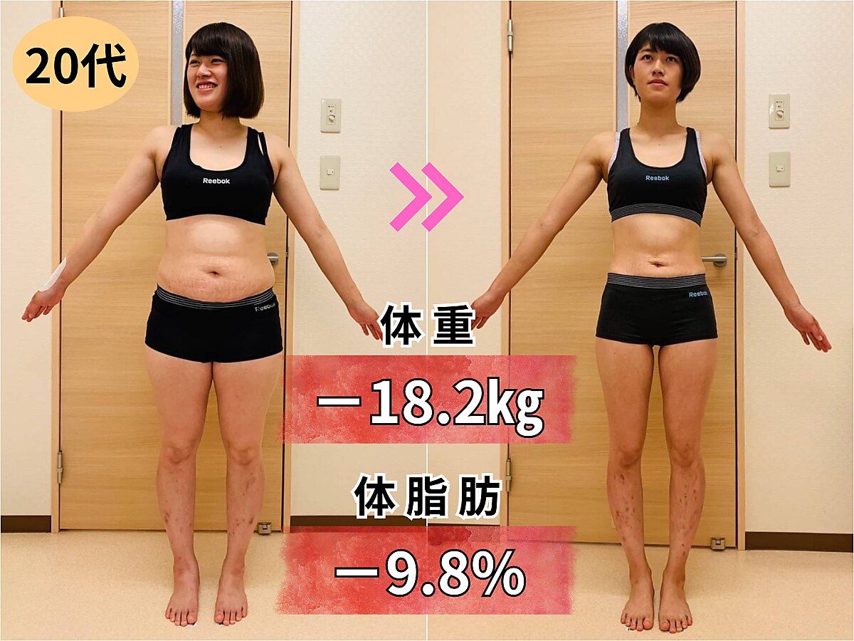 簡単ダイエット無刺激★高周波温熱美肌献身美容器★ビューティワールドお求めの方にも Amazon.co.jp: yete 美顔器 ボディ美容器 1台多役 超音波 RF 5段階の