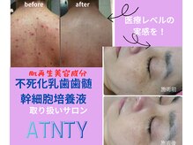 今まで解決しなかったお悩みpurebeautyに持ち込んでください
