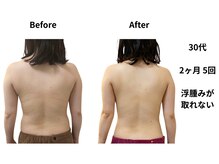 ジャジャン(jajan)/浮腫みが改善して細くなりました