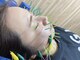 アークス(ARQS)の写真/《新メニュー！》フェイシャル美容鍼が初回￥3500♪速攻小顔効果＆リフトアップにも◎