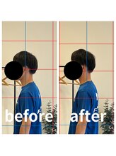 熊本カワル整体 JR上熊本駅院/首肩の痛み