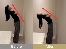 せなかのはね 難波心斎橋店/20代 猫背 肩こり 腰痛